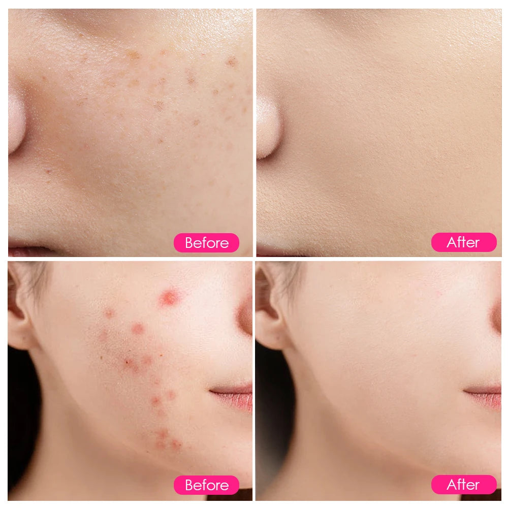 Lumiére LED Red Light Photon Therapy Face Mask