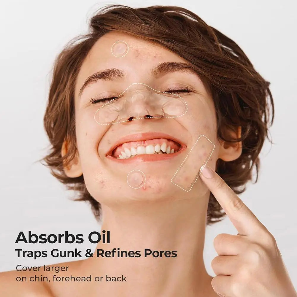 Lumiére Pimple Patches for Acne & Blemishes
