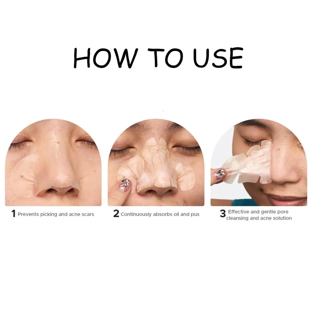 Lumiére Pimple Patches for Acne & Blemishes