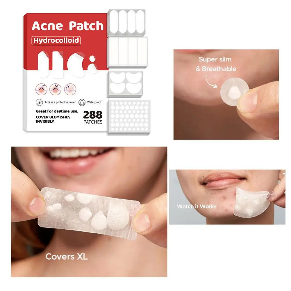 Lumiére Pimple Patches for Acne & Blemishes