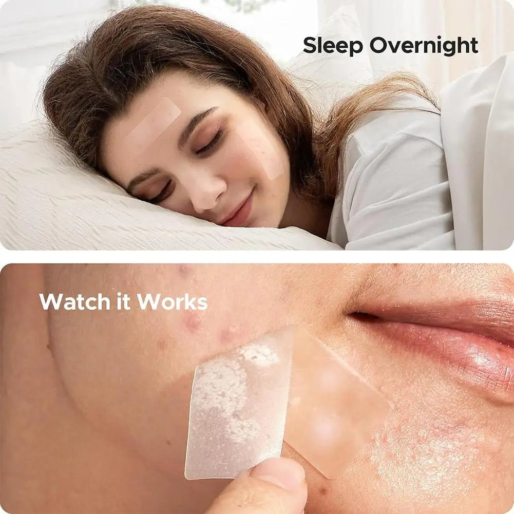 Lumiére Pimple Patches for Acne & Blemishes
