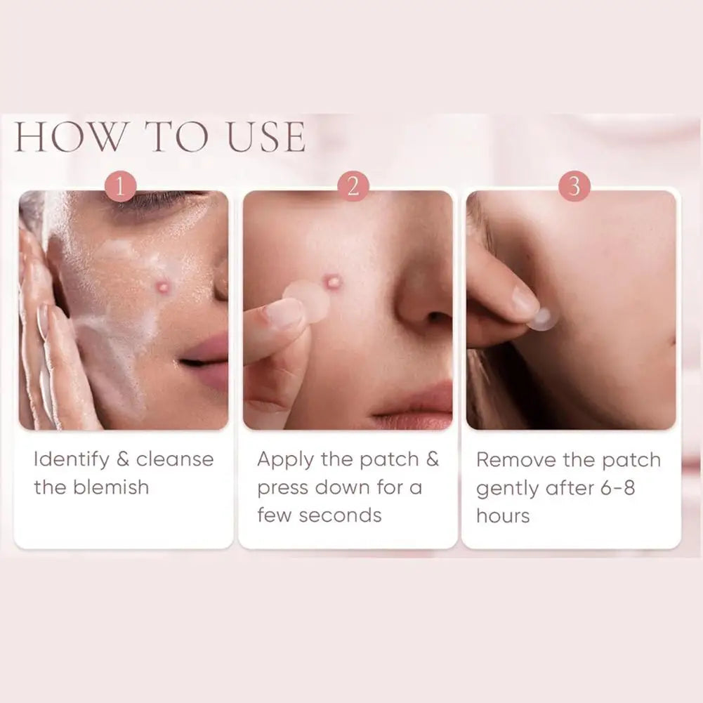 Lumiére Pimple Patches for Acne & Blemishes