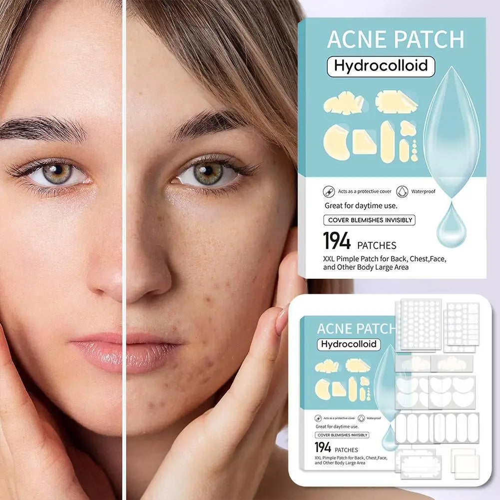 Lumiére Pimple Patches for Acne & Blemishes