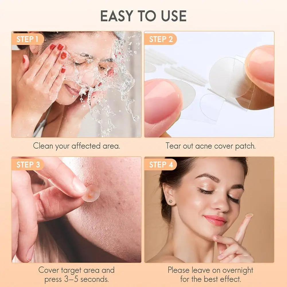 Lumiére Pimple Patches for Acne & Blemishes