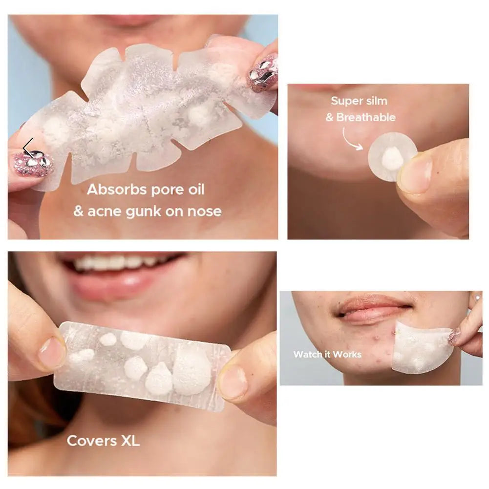 Lumiére Pimple Patches for Acne & Blemishes