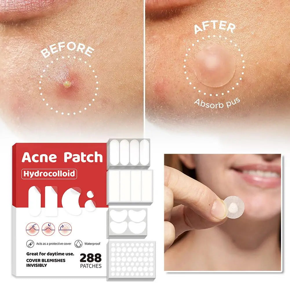 Lumiére Pimple Patches for Acne & Blemishes